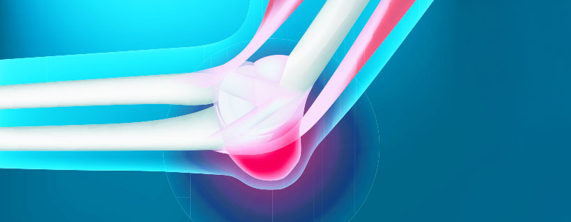 patient needing Bursitis chiropractor in Charlotte NC