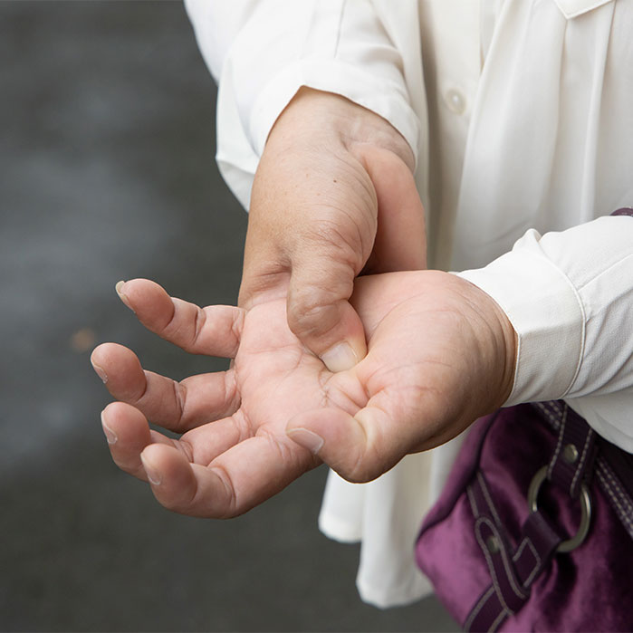 dupuytren contracture chiropractor in Charlotte NC