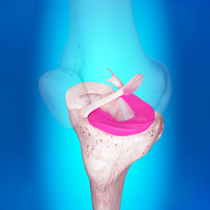 Ligamentitis chiropractor in Charlotte NC