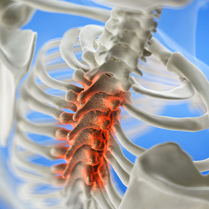 spinal stenosis treatment in Charlotte NC